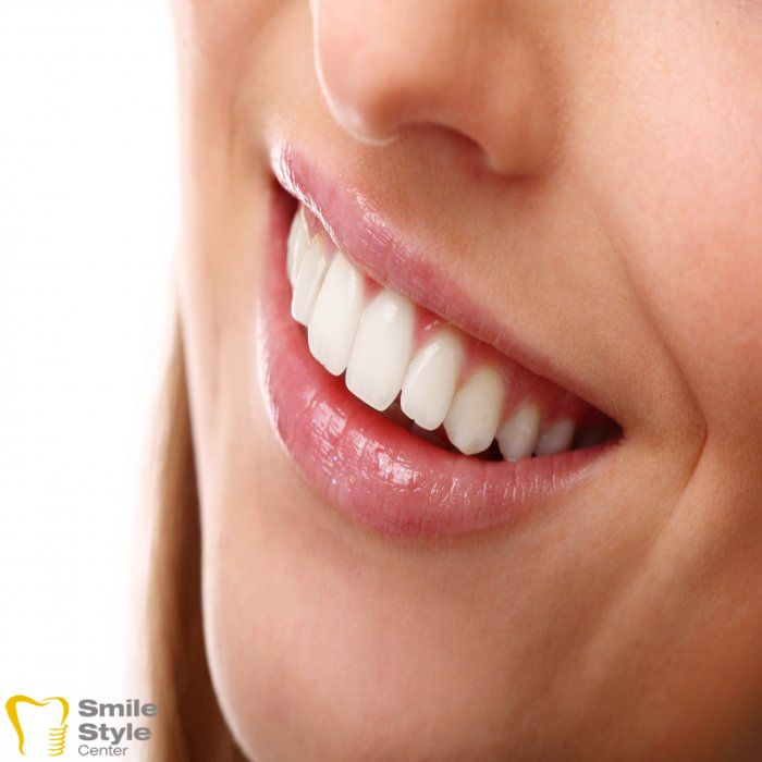 holywood smile Turkey