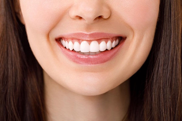 Teeth Whitening in Turkey